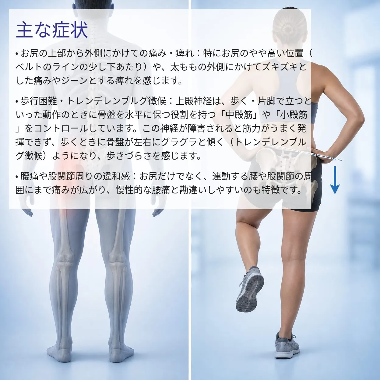 坐骨神経痛でお悩みの方へ。