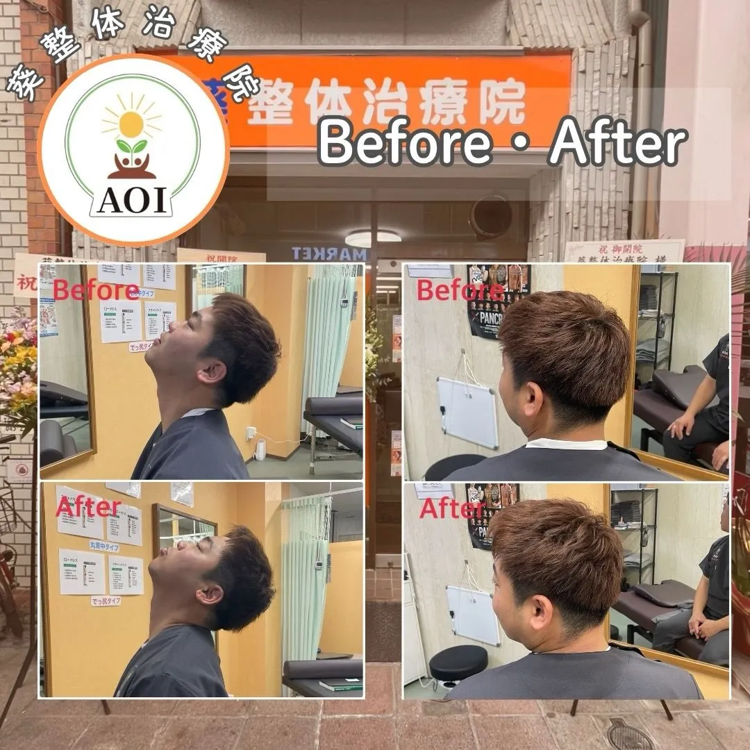 院長の首の痛みが改善されました✨