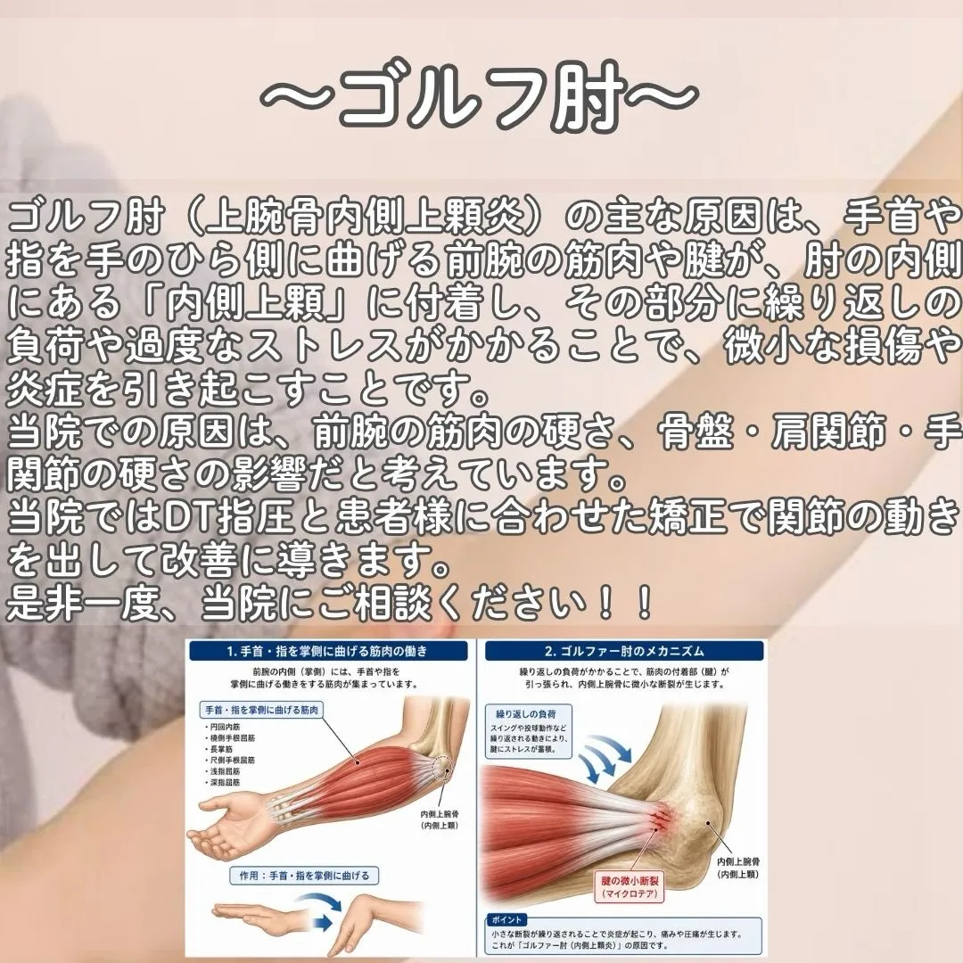 肘の痛みにお悩みですか？🏌️‍♂️💥 