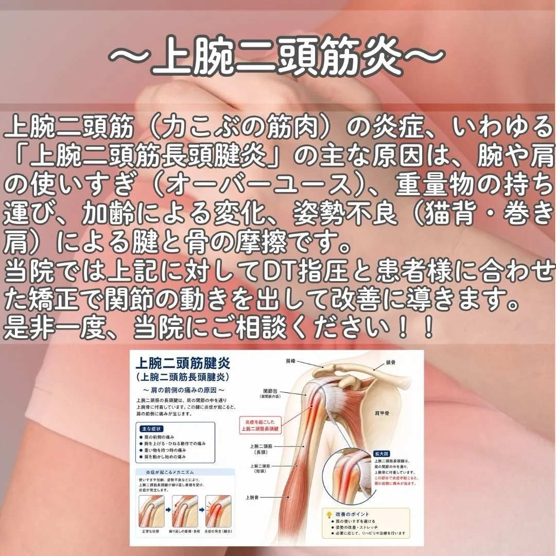 肩の痛みに悩んでいませんか？